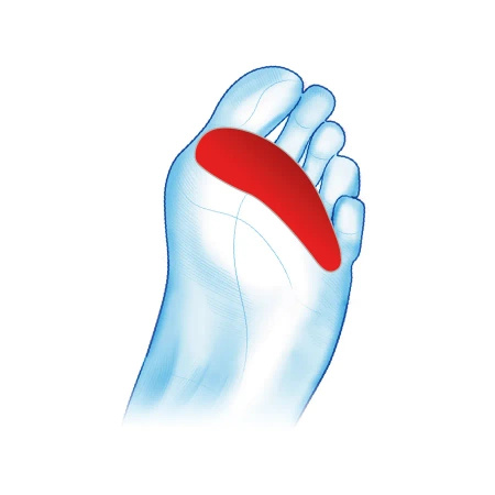 HAMMER GEL hammer toe rings MS497- Mazbit Medic Line